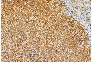 ABIN6263284 and ABIN6272925 at 1/100 staining Rat stomach tissue by IHC-P. (MLYCD 抗体  (Internal Region))