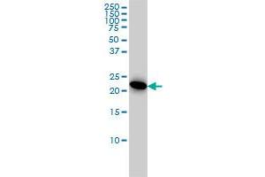 Adenylate Kinase 1 抗体  (AA 1-194)