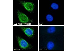 ABIN185241 Immunofluorescence analysis of paraformaldehyde fixed HeLa cells, permeabilized with 0. (RNF125 抗体  (C-Term))