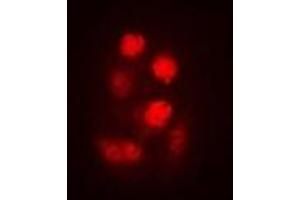 Immunofluorescent analysis of SEN2 staining in A549 cells. (TSEN2 抗体)