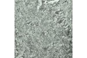 IHC on mouse brain (cryo section) using Rabbit antibody to Synaptotagmin 17  at a concentration of 50 µg/ml incubated overnight at 4C. (SYT17 抗体  (Internal Region))