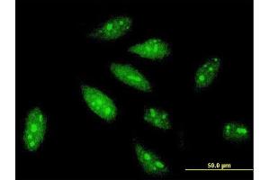 Immunofluorescence of monoclonal antibody to TRIM56 on HeLa cell. (TRIM56 抗体  (AA 656-755))