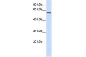 Image no. 1 for anti-Forkhead Box O4 (FOXO4) (AA 108-157) antibody (ABIN6744334) (FOXO4 抗体  (AA 108-157))