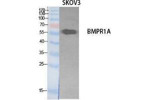 Western Blotting (WB) image for anti-Bone Morphogenetic Protein Receptor 1A (BMPR1A) (Internal Region) antibody (ABIN3178544) (BMPR1A 抗体  (Internal Region))
