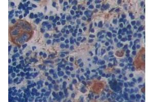 Detection of ITGb3 in Mouse Spleen Tissue using Polyclonal Antibody to Integrin Beta 3 (ITGb3) (Integrin beta 3 抗体  (AA 134-376))