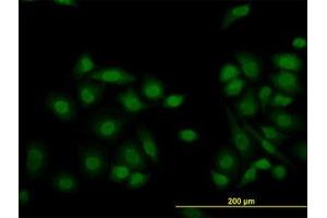 Image no. 1 for anti-Lysine (K)-Specific Demethylase 5B (KDM5B) (AA 231-320) antibody (ABIN599151) (KDM5B 抗体  (AA 231-320))