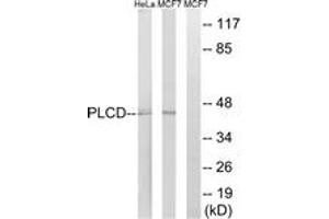 Western Blotting (WB) image for anti-1-Acylglycerol-3-Phosphate O-Acyltransferase 4 (AGPAT4) (AA 151-200) antibody (ABIN2890034)