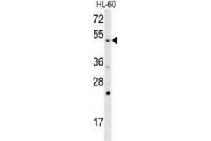 Western Blotting (WB) image for anti-Nitric Oxide Synthase 1 (Neuronal) Adaptor Protein (NOS1AP) (AA 444-474), (Middle Region) antibody (ABIN953737)