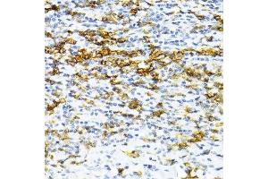 Immunohistochemistry of paraffin-embedded human tonsil using SNRNP70 antibody. (SNRNP70 抗体  (AA 150-250))