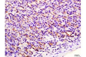 Paraformaldehyde-fixed, paraffin embedded rat stomach tissue, Antigen retrieval by boiling in sodium citrate buffer(pH6) for 15min, Block endogenous peroxidase by 3% hydrogen peroxide for 30 minutes, Blocking buffer (normal goat serum) at 37°C for 20min, Antibody incubation with Rabbit Anti-SIRT4 Polyclonal Antibody, Unconjugated  at 1:400 overnight at 4°C, followed by a conjugated secondary and DAB staining (SIRT4 抗体  (AA 51-150))