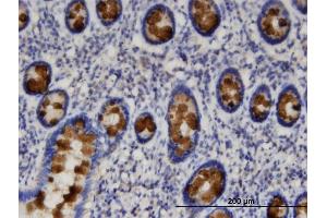 Immunoperoxidase of monoclonal antibody to SLC9A3R1 on formalin-fixed paraffin-embedded human small Intestine.