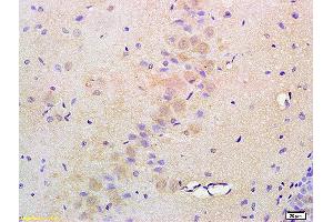 Formalin-fixed and paraffin embedded rat brain labeled with Anti-ATF6 Polyclonal Antibody, Unconjugated (ABIN732293) at 1:200 followed by conjugation to the secondary antibody and DAB staining (ATF6 抗体  (AA 301-400))
