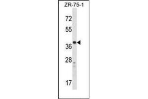 Western blot analysis of CYSLTR1 Antibody (Center) in ZR-75-1 cell line lysates (35ug/lane).