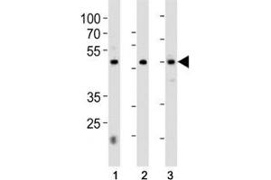 HNF4A antibody western blot analysis in 1) 293, 2) HepG2 cell line and 3) rat liver tissue lysate. (HNF4A 抗体  (AA 281-312))