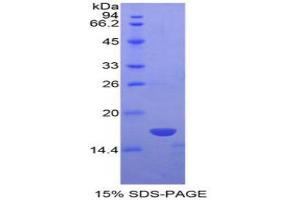 SDS-PAGE analysis of Human NME4 Protein. (Non Metastatic Cells 4, Protein NM23A Expressed In 蛋白)