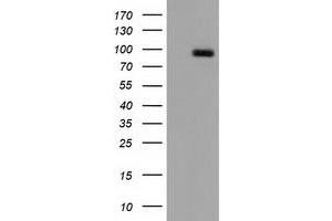 Western Blotting (WB) image for anti-CUB Domain Containing Protein 1 (CDCP1) antibody (ABIN1497413) (CDCP1 抗体)