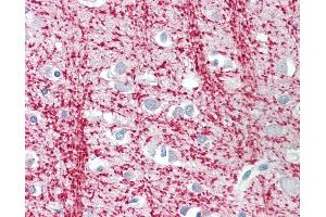 Anti-TPPP antibody IHC staining of human brain, cortex. (Tppp 抗体  (AA 21-35))