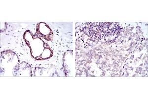 Immunohistochemical analysis of paraffin-embedded prostate tissues (left) and bladder cancer tissues (right) using NFKB1 mouse mAb with DAB staining.