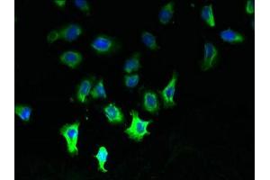 Immunofluorescent analysis of A549 cells using ABIN7146318 at dilution of 1:100 and Alexa Fluor 488-congugated AffiniPure Goat Anti-Rabbit IgG(H+L) (CCDC109B 抗体  (Regulatory Subunit))