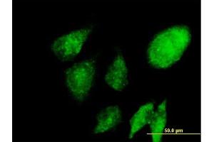 Immunofluorescence of purified MaxPab antibody to NACA on HeLa cell. (NACA 抗体  (AA 1-215))