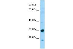 WB Suggested Anti-SPAG7 Antibody Titration: 1. (SPAG7 抗体  (N-Term))