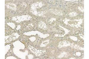 ABIN6258622 and ABIN6273497 at 1/100 staining human normal kidney tissue by IHC-P.