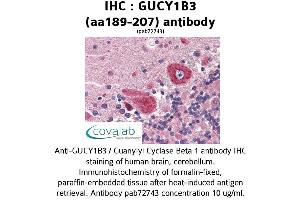 Image no. 1 for anti-Guanylate Cyclase 1, Soluble, beta 3 (GUCY1B3) (AA 189-207) antibody (ABIN2852385) (GUCY1B3 抗体  (AA 189-207))