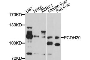 Western blot analysis of extracts of various cell lines, using PCDH20 antibody (ABIN5998470) at 1/1000 dilution. (PCDH20 抗体)