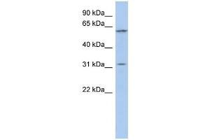 WB Suggested Anti-C1orf110 Antibody Titration: 0. (C1ORF110 抗体  (Middle Region))