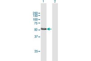 Western Blot analysis of RRP1 expression in transfected 293T cell line by RRP1 MaxPab polyclonal antibody. (RRP1 抗体  (AA 1-461))