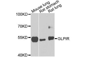Western blot analysis of extracts of various cells, using GLP1R antibody. (GLP1R 抗体)