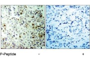 Image no. 1 for anti-Cyclin-Dependent Kinase 2 (CDK2) (pThr160) antibody (ABIN196844) (CDK2 抗体  (pThr160))