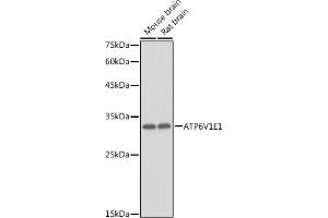 Western blot analysis of extracts of various cell lines, using V1E1 antibody (ABIN1678795, ABIN3018056, ABIN3018057 and ABIN6220346) at 1:1000 dilution. (ATP6V1E1 抗体  (AA 77-226))