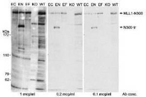 Image no. 1 for anti-Lysine (K)-Specific Methyltransferase 2A (KMT2A) (AA 720-780), (N-Term) antibody (ABIN328575) (Lysine (K)-Specific Methyltransferase 2A (KMT2A) (AA 720-780), (N-Term) 抗体)