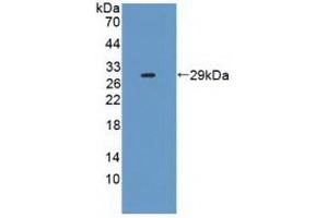 Detection of Recombinant IL2Ra, Human using Polyclonal Antibody to Interleukin 2 Receptor Alpha (IL2Ra) (CD25 抗体  (AA 22-213))