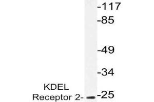 Western blot (WB) analysis of KDEL Receptor 2 antibody in extracts from HUVEC cells. (KDELR2 抗体)