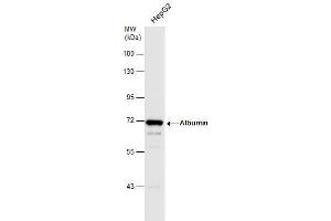 WB Image Whole cell extract (30 μg) was separated by 7. (Albumin 抗体  (C-Term))