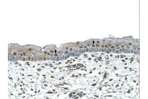 Immunohistochemistry (IHC) image for anti-Nuclear Receptor Subfamily 2, Group C, Member 2 (NR2C2) (C-Term) antibody (ABIN630120)
