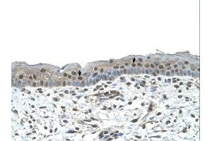 NR2C2 antibody was used for immunohistochemistry at a concentration of 4-8 ug/ml. (TR4 抗体  (C-Term))