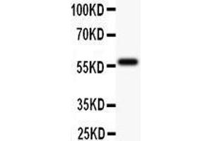 Anti-TdT Picoband antibody,  All lanes: Anti TDT  at 0. (TdT 抗体  (AA 316-509))
