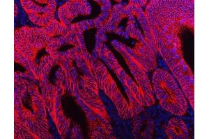 IF analysis of NKCC1/SLC12A2 using anti-NKCC1/SLC12A2 antibody (ABIN7602601).