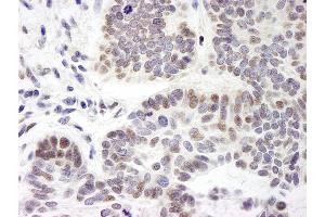 anti-Zinc Finger Protein 261 (ZMYM3) (AA 250-300) antibody