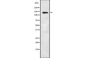 Western blot analysis of KCNT1 using K562 whole cell lysates (KCNT1 抗体  (C-Term))