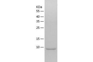 Western Blotting (WB) image for Chemokine (C-C Motif) Ligand 17 (CCL17) (AA 24-93) protein (His tag) (ABIN7288721) (CCL17 Protein (AA 24-93) (His tag))