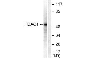 Western blot analysis of extracts from NIH/3T3 cells, using HDAC1 antibody (#C0221). (HDAC1 抗体)