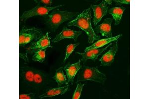 IF analysis of Cyclophilin E/PPIE using anti-Cyclophilin E/PPIE antibody (ABIN7599242). (PPIE 抗体  (AA 1-301))