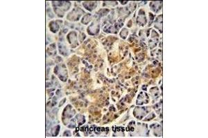 PRSS3 antibody (N-term) (ABIN654446 and ABIN2844180) immunohistochemistry analysis in formalin fixed and paraffin embedded human pancreas tissue followed by peroxidase conjugation of the secondary antibody and DAB staining.