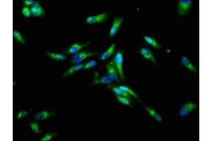 Immunofluorescence staining of Hela cells with ABIN7161356 at 1:133, counter-stained with DAPI. (CHRNB3 抗体  (AA 67-218))