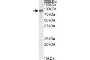GRIA4 polyclonal antibody  (0. (GRIA4 抗体)