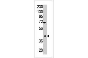 Western blot analysis of TPST2 polyclonal antibody  in A2058 cell line lysate (35 ug/lane). (TPST2 抗体  (C-Term))